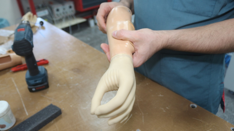 ORTEZ PROTEZ MERKEZİ, ENGELLİ AFETZEDELERİN UMUDU OLUYOR - TÜRKİYE - İnternetin Ajansı